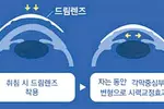“만1세-사시, 3세-약시, 6세-안경필요성 검사를”