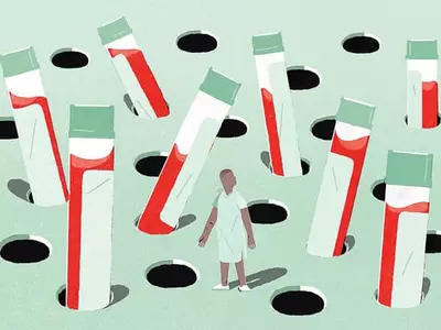 전립선암 검사‘PSA’ 꼭 필요한가