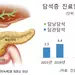 자주 체하고 명치부위 복통… 위에 이상 없으면 담석 때문?