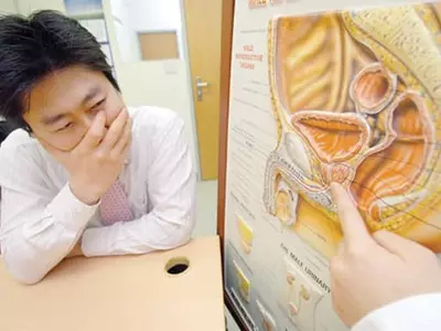 전립선비대증은 노인병?‘젊은 당신’도 위험하다