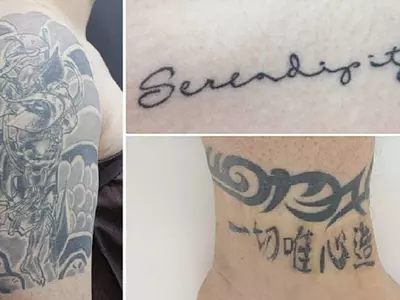 문신, 레이저로 쉽게 지운다?…“1년간 10회 이상 시술 필요”