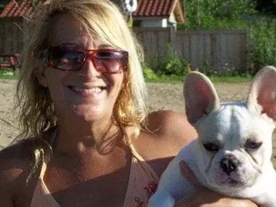 50대 여성, 기르던 반려견에 물려 사망