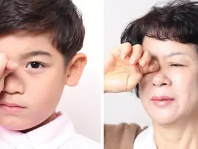 눈 찌르고 각막·결막 상처내는 속눈썹… 뽑으면 그만?