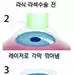 라식·라섹 받은 백내장 환자, 5%는 재수술 받아야
