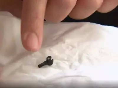 의사도 놓쳤는데…2년전 실수로 삼킨 레고조각 코풀다 '불쑥'