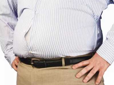 비만일수록 대장암‘씨앗’대장 용종 ↑