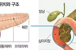 황달·명치 통증 지속땐 췌장암 정밀진단을