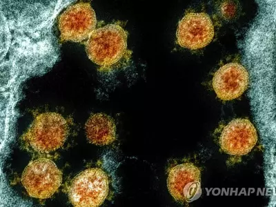 미국서 코로나 재감염 첫 사례…"두 번째 때 증상 더 심각"