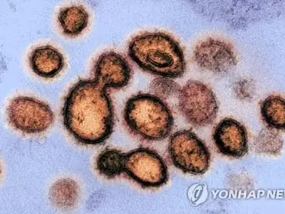 미국 내 영국발 변이 코로나 감염자 12개주 76명으로 늘어