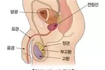 "아스피린, 방광암·유방암 생존율↑"