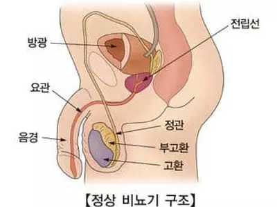 "아스피린, 방광암·유방암 생존율↑"