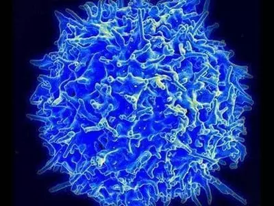 사람마다 다른 항암 면역력? 열쇠는 T세포가 갖고 있다