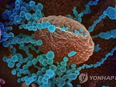 전세계 코로나 사망 400만명 넘어…델타변이가 가을 유행 '복병'