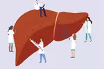 98%가 치료할 수 있는데… C형 간염, 대부분 몰라서 방치