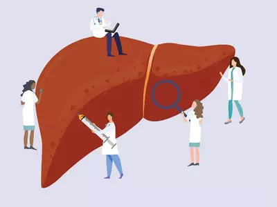 98%가 치료할 수 있는데… C형 간염, 대부분 몰라서 방치