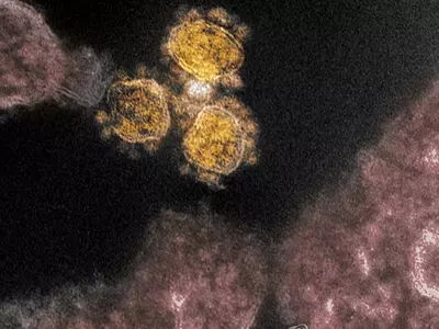 새 변이 오미크론 출현 전세계 비상