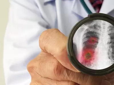 코로나19로 망가진 폐 왜 그렇게 치명적일까