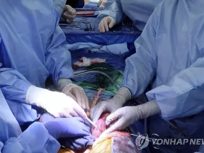 '돼지 신장 인체 이식' 수술하는 앨라배마대 의료진
