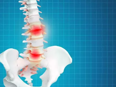 ‘현대인의 고질병’척추 질환 예방하려면…