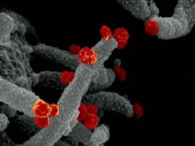 코로나19 환자 12% 겪는 '후각 이상', 뇌 손상 전조일 수 있다