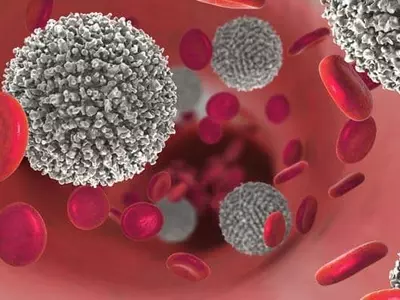 심하면 1주일 만에 사망하는 이 희소 질환은?