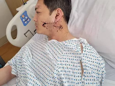 30대한인 인종혐오 공격 당해