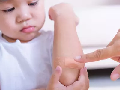 어린 자녀 흉터 안 생기게 하려면…