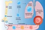 경증 코로나19 환자의 장기 후유증, 대식세포가 일으킨다