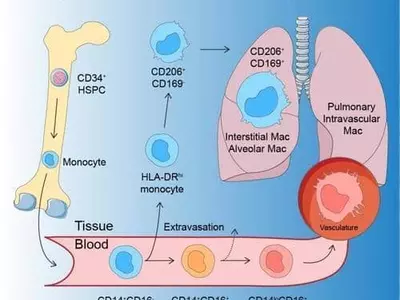 경증 코로나19 환자의 장기 후유증, 대식세포가 일으킨다
