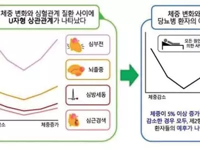 당뇨병 환자, 몸무게 크게 변하면 심혈관 질환 위험 높아