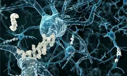 초기 알츠하이머 당일 진단…FDA, 치매 진단법 승인