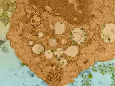 '무증상부터 사망까지'…코로나19 위중도, 대식세포가 결정한다