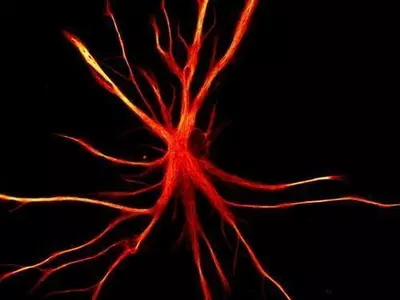 50대 이후 치매, 연령ㆍ위험 요인 따라 '천차만별'