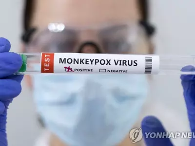 CDC, 해외여행 ‘원숭이 두창’ 경보