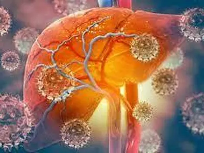 원인불명 급성간염 33개국 거의 유아들