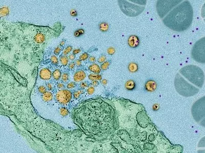 염증이 암 유발하는 거 맞다…'DNA 손상' 경로 확인