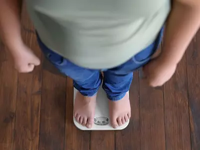 [의학카페] 과체중 비만 청소년, 1형 당뇨병 위험↑