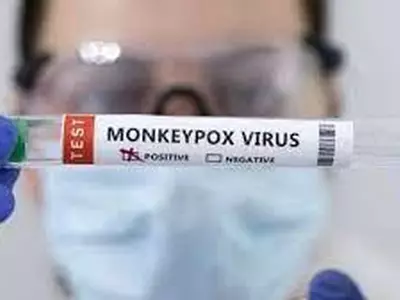 ‘원숭이두창’ 경보 격상…36개국 1,100명 돌파