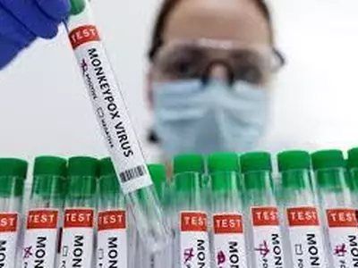 “공기전염 배제 못해” CDC, 원숭이두창 경고