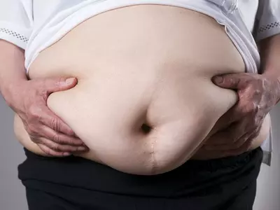 비만-암 상관관계 추적“체중 감량하면 암 위험 감소”