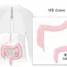 대장암 유발하는‘궤양성 대장염’10년 새 4.8배