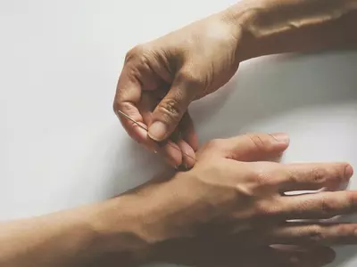 ‘바람만 스쳐도 아픈’통풍에 봉독 약침 효과