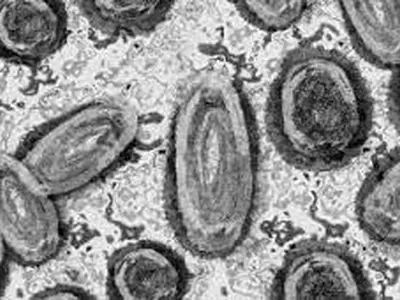 리스테리아 집단 발병 10개주 확산, 22명 입원