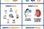 출산통 같은 옆구리 고통이…여름철 복병‘요로결석’