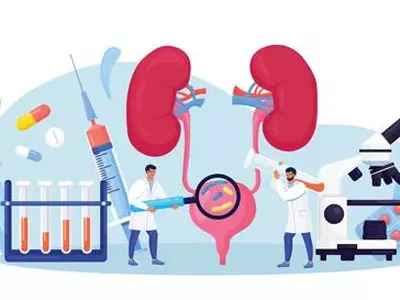 커피 많이 마시면‘3대 통증 질환’요로결석 발생한다?