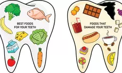 [의학카페] “치아건강 위해 음식·음료 선별 해야”