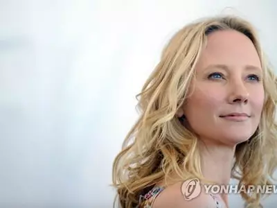 배우 앤 헤이시, 뇌사후 장기기증…연명치료 중단