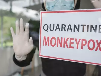 원숭이두창 반려동물 격리, CDC 21일 격리 새 지침