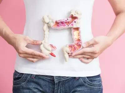 어떤 색깔 혈변이 대장암 때문일까?