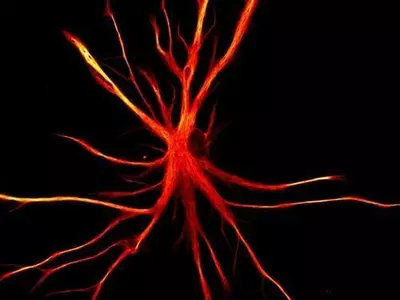 치매, 마침내 정복? 뇌의 독성 단백질 제거 '신호 경로' 발견